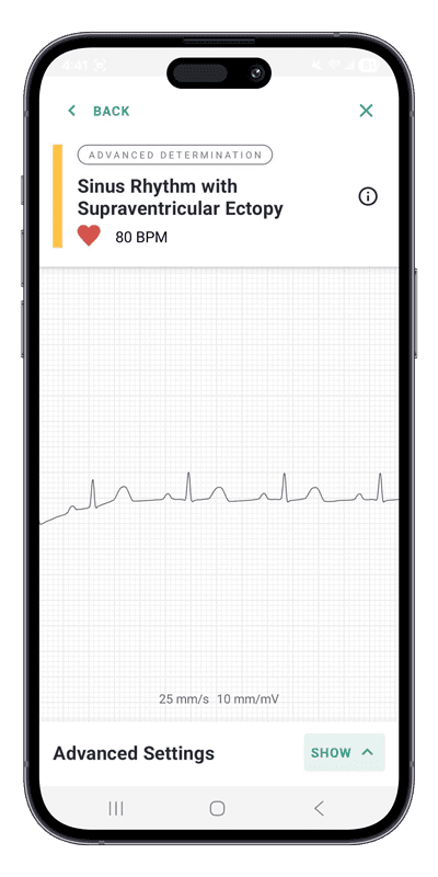 Advanced Determinations