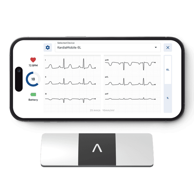 Kardia: Personal ECG Devices by AliveCor