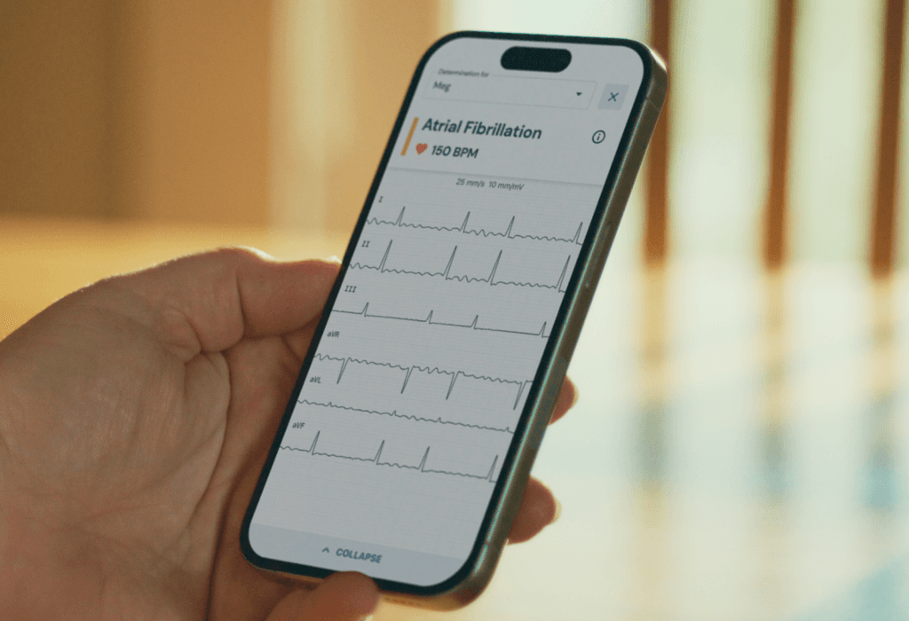 /what-is-afib