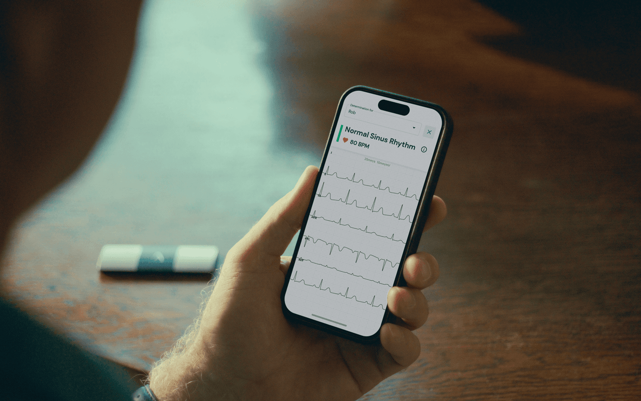 /what-is-an-ekg-3