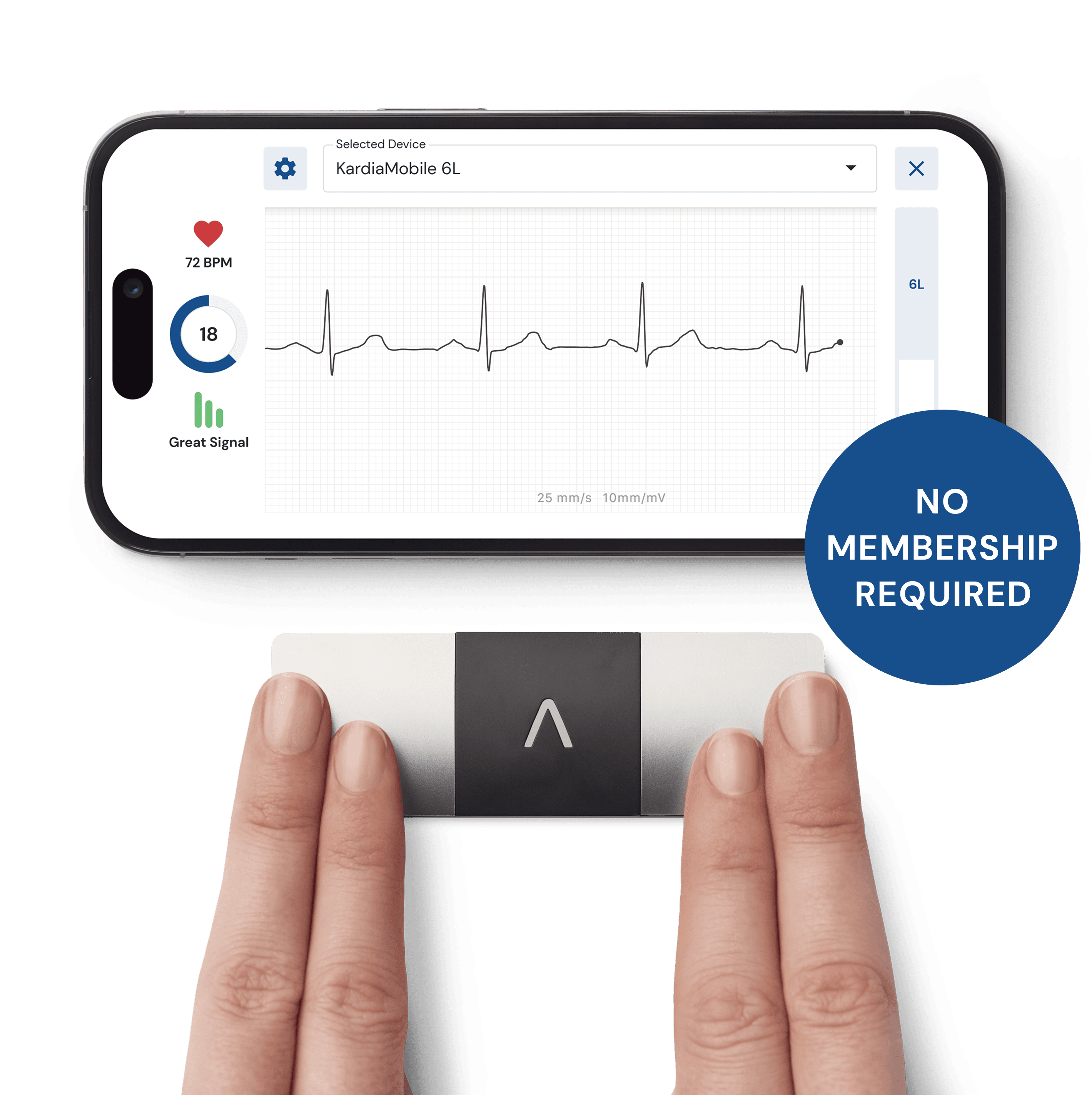 Kardia app showing a full six-lead EKG