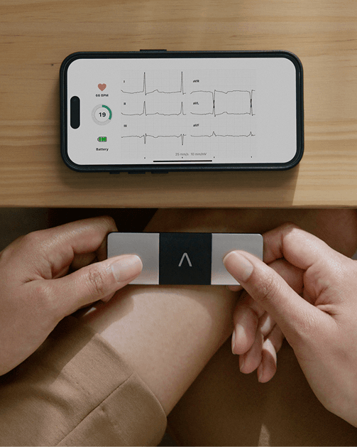 Recording a six-lead EKG