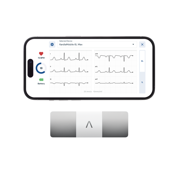 EKG Monitor with 6 Leads | KardiaMobile 6L Max by AliveCor