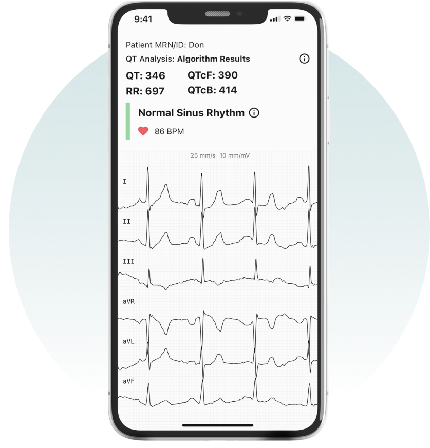 MindtecStore Europe - What can the Kardia Mobile 6L actually do? The  AliveCor Kardia Mobile 6L is your personal smartphone ECG that fits easily  in your pocket. Record an unlimited number of