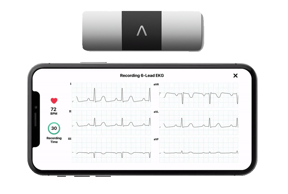 Portable Six-Lead Heart Monitor, KardiaMobile 6L
