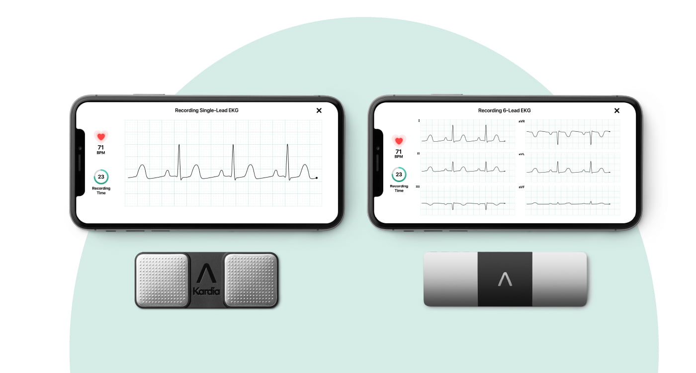 Alivecor Kardiamobile 6L Personal EKG Device that detects AFib